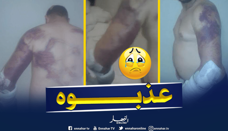 بالصور والفيديو.. الجيش اليوناني يعذب “حراڤ” جزائري بالكهرباء