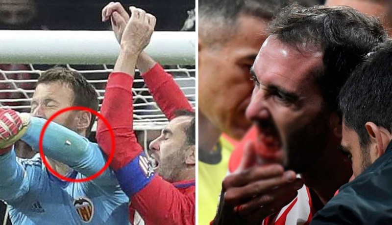 بالفيديو.. مدافع أتليتكو مدريد يفقد أسنانه !