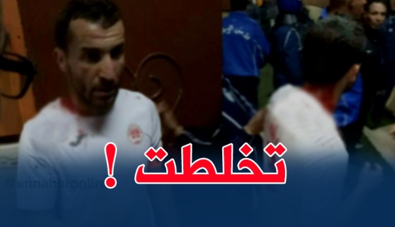 بالصور..إعتداء خطير على لاعب الخروب في أم البواقي !