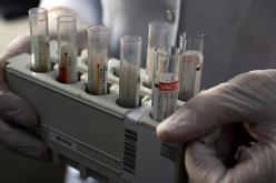 تسجيل 5 وفيات بـ”انفلونزا الخنازير” في المغرب