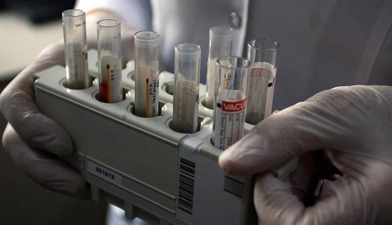 تسجيل 5 وفيات بـ”انفلونزا الخنازير” في المغرب