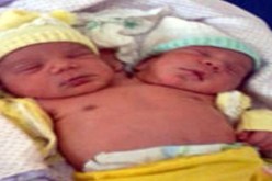 برازيلية تضع طفلا برأسين‮