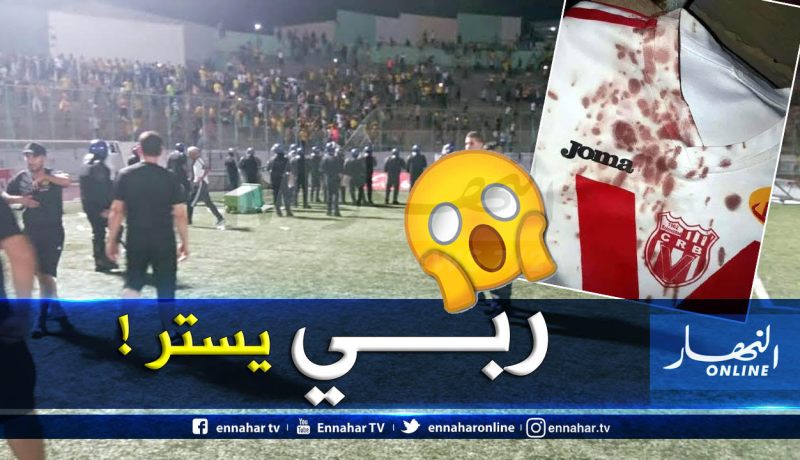 7 غرزات في رأس حارس عتاد شباب بلوزداد “بن يوسف”