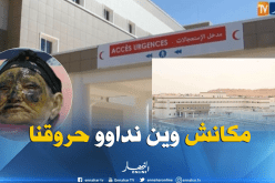 بالفيديو ..مواطنو الأغواط يطالبون بفتح مصلحة لعلاج الحروق