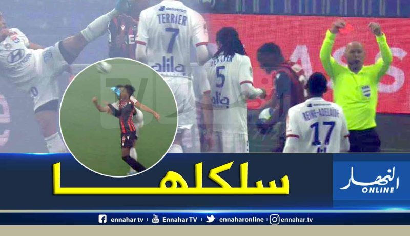 “بوداوي” ينجو من إصابة خطيرة على مستوى الوجه