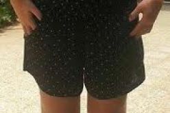 منع شابة من العلاج بسبب ارتدائها تنورة قصيرة في وهران