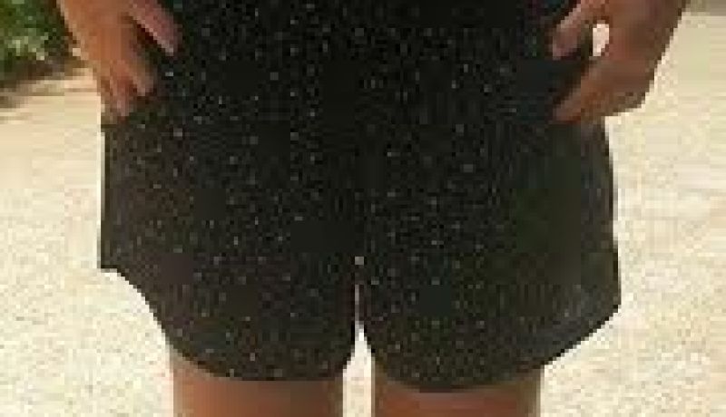 منع شابة من العلاج بسبب ارتدائها تنورة قصيرة في وهران