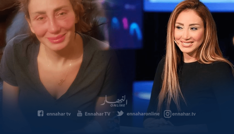 ريهام سعيد تفجر مفاجأة: “الطبيب أزال أنفي بالكامل وحياتي مازالت مهددة”!