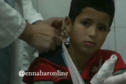 50 بالمائة من المحروقين لا يتجاوز سنهم 10 سنوات