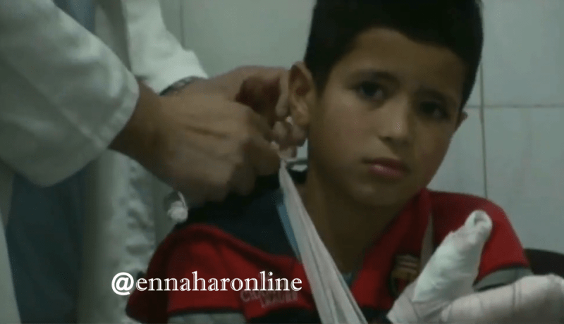 50 بالمائة من المحروقين لا يتجاوز سنهم 10 سنوات