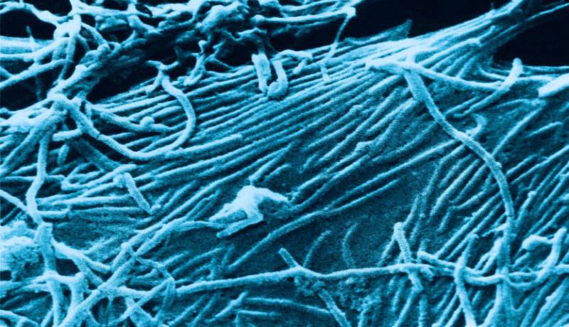 ظهور مرض الدودة الحلزونية الخطير لدى 3 اشخاص في سوريا