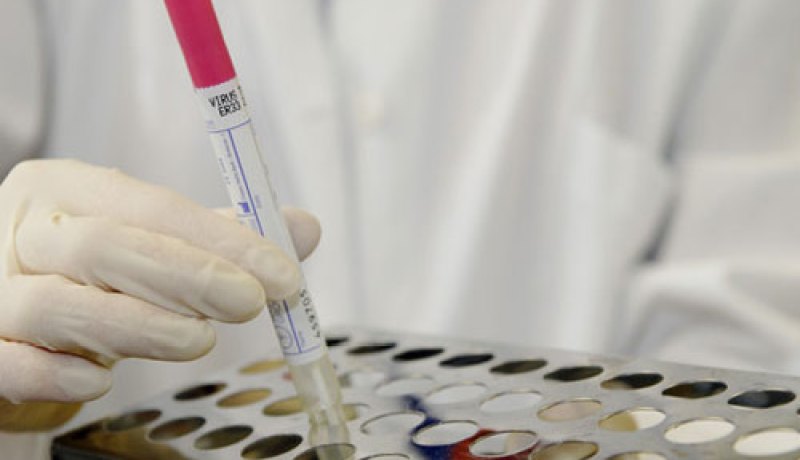 وفاة معتمر من تلمسان متأثرا بمضاعفات فيروس كورونا