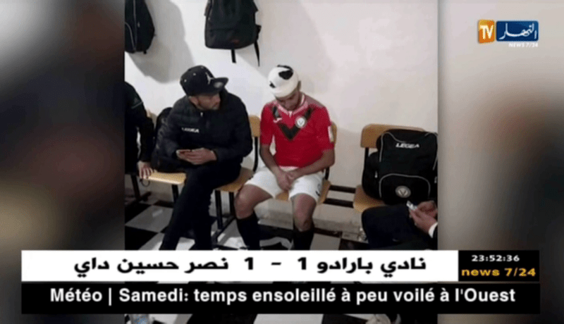 لاعب شبيبة سكيكدة أوصالح يصاب في الرأس بقارورة خمر في عين الفكرون