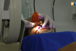 صحة: جزائريون يصرفون مبالغ خيالية على عمليات تجميل الأسنان