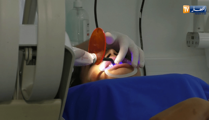 صحة: جزائريون يصرفون مبالغ خيالية على عمليات تجميل الأسنان