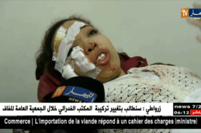 مستغانم: قتيل و 26 جريحا إثر إنقلاب حافلة لنقل المسافرين بالطريق الوطني رقم 17