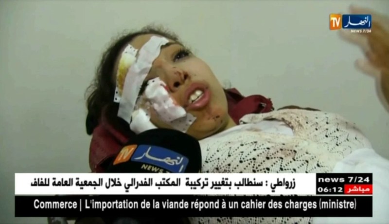 مستغانم: قتيل و 26 جريحا إثر إنقلاب حافلة لنقل المسافرين بالطريق الوطني رقم 17