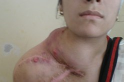 خطأ طبي يحول ألم التلميذة وافية إلى إعاقة دائمة… وتهديد حقيقي بالموت:”أناشد عمار تو التعجيل بتحويلي للعلاج في الخارج وإنقاذي من إعاقة أكيدة”