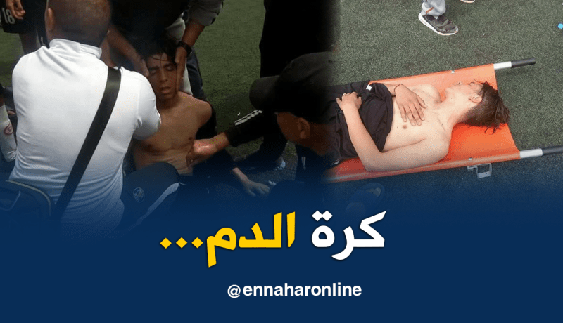 بالصور.. العنف ينتقل من المُحترف الأوّل إلى الآمال في أندية الهواة