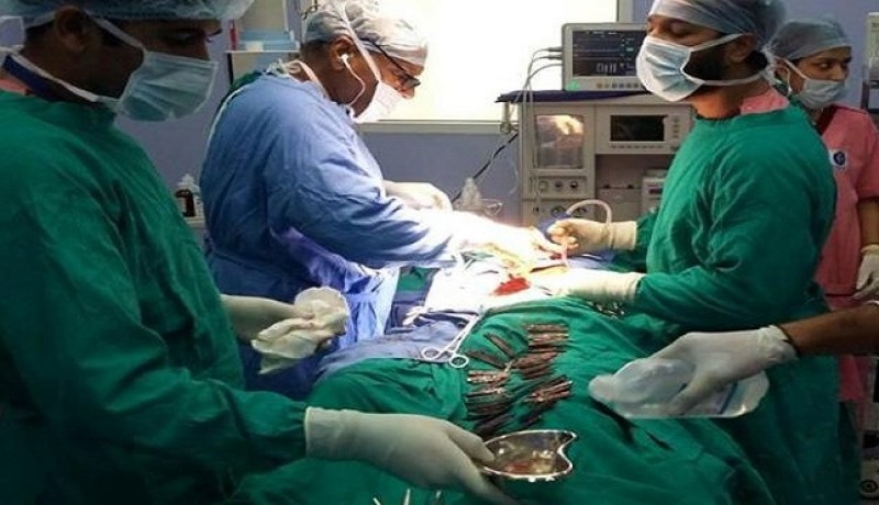 بالصور فريق طبي ينجح في إزالة 40 سكينا من بطن رجل