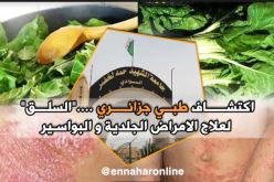 اكتشاف طبّي جزائري.. “السلق” يعالج الأمراض الجلدية و البواسير