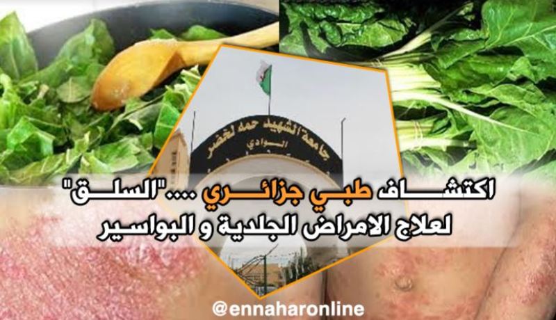 اكتشاف طبّي جزائري.. “السلق” يعالج الأمراض الجلدية و البواسير
