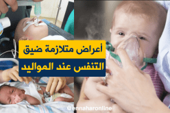 أعراض متلازمة ضيق التنفس عند المواليد