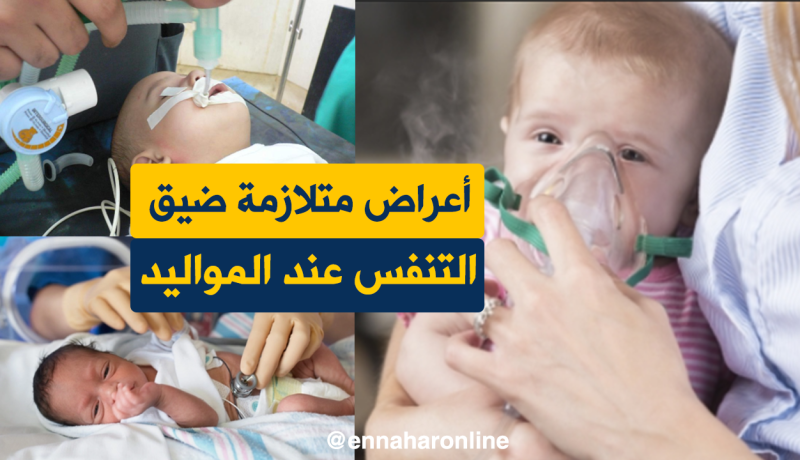 أعراض متلازمة ضيق التنفس عند المواليد