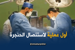طاقم طبي شاب يجري أول عملية جراحية لاستئصال الحنجرة بمستغانم