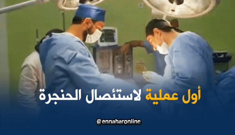 طاقم طبي شاب يجري أول عملية جراحية لاستئصال الحنجرة بمستغانم