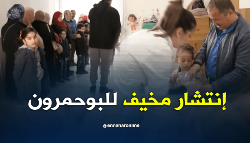 الإشتباه في إصابة 6 أشخاص بداء الحصبة بغليزان