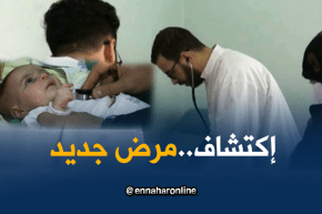 البيض: طبيب مختص يجد علاج لمرض يصيب الأطفال بعد الدقة في التشخيص