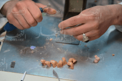 مرسوم وزاري يسمح للمستثمرين الخواص بالإستثمار في الأعضاء الإصطناعية قريبا