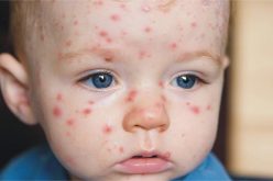 الوادي :  إشتباه في وفاة رضيعين بمستشفى الأم والطفل بشير بن ناصر بالبوحمرون