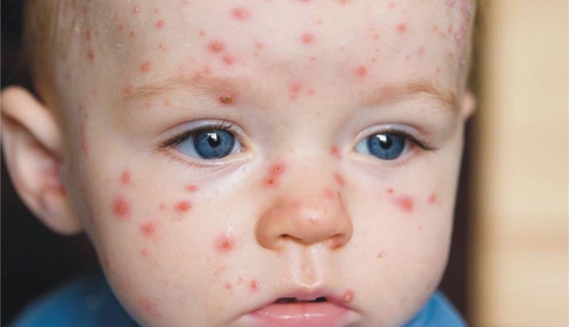 الوادي :  إشتباه في وفاة رضيعين بمستشفى الأم والطفل بشير بن ناصر بالبوحمرون