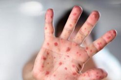 تسجيل حالة جديدة للبوحمرون في برج بوعريريج