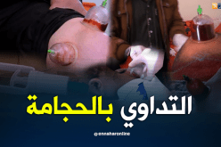 الحجامة.. علاج متداول رغم تطور الطب