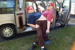 وفاة أكبر توأم ملتصق في العالم عن عمر ناهز 68 سنة