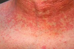 بوسعادة : مصالح البلدية تصدر بيانا لتوعية المواطنين بعد تسجيل  حالات إصابة بالحمى المالطية