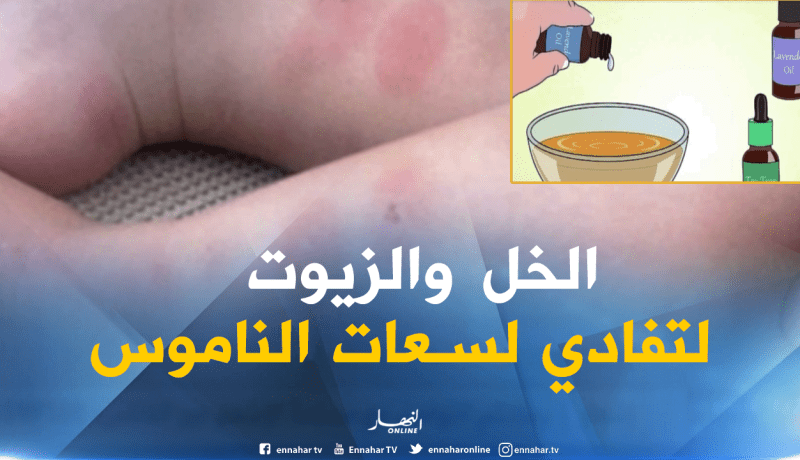 بالفيديو ..الخل وزيت الزيتون للوقاية من لسعة الناموس