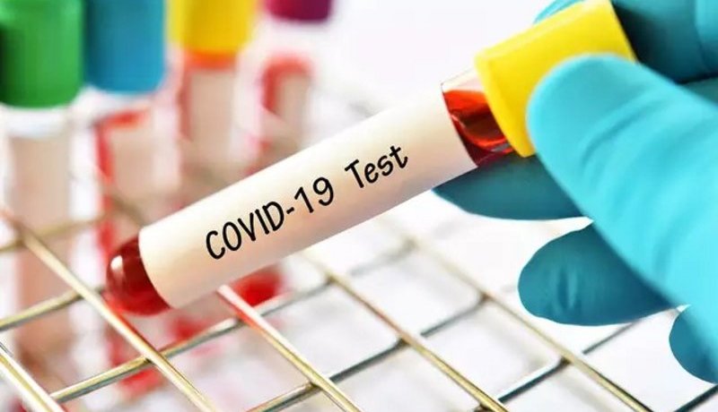 شفاء معمّرة سعودية عمرها 101 سنة من فيروس “كورونا”