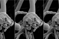 مصر.. وزارة الصحة تكشف حقيقة الإصابات بالفطر الأسود