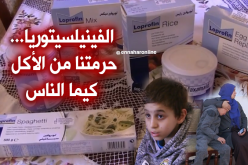 الفينيلسيتوريا.. مرض نادر يفتك بحياة الأطفال