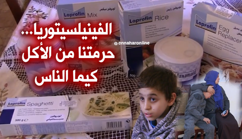 الفينيلسيتوريا.. مرض نادر يفتك بحياة الأطفال