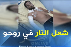 شاب يضرم النار في جسده أمام مقر ولاية المدية