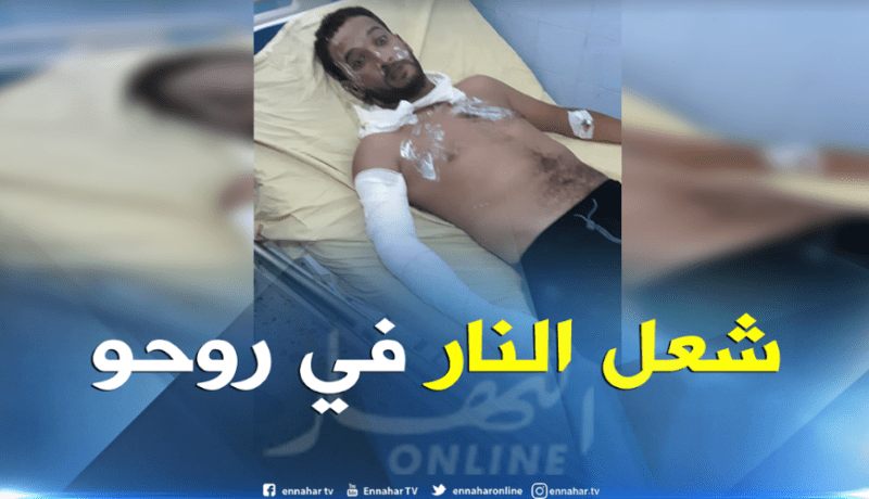 شاب يضرم النار في جسده أمام مقر ولاية المدية