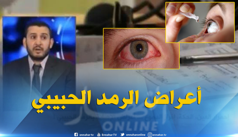 بالفيديو ..تعرف على أعراض الإصابة بمرض الرمد الحبيبي