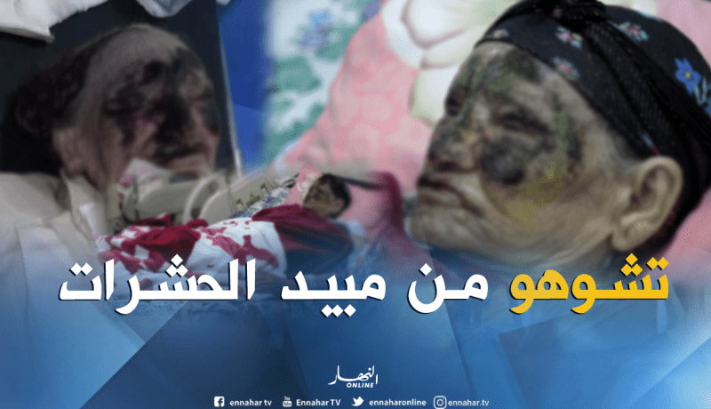 مبيد الحشرات الذي تطلقه مصالح البلدية يتسبب في تشوه خلقي لإمرأتان في الأغواط