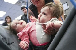 توأم سيامي تتعلمان المشي بزيّ خاص