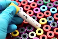 وفاة جزائري من الوادي بعد إصابته بأنفلونزا الخنازير في تونس